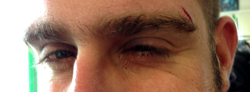 Regard de braise